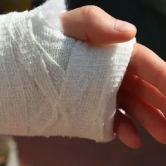 Sennik złamana ręka u kogoś: Co zwiastuje ten niepokojący symbol w śnie