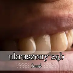 Co oznacza sen o ukruszonym zębie - poznaj ukryte znaczenie i symbolikę